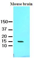 Western blot analysis: Cell lysates of mouse brain (60 ug) were resolved by SDS-PAGE, transferred to NC membrane and probed with anti-human FABP7 (1:1000). Proteins were visualized using a goat anti-mouse secondary antibody conjugated to HRP and an ECL detection system.