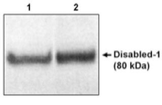 Western blot analysis using Disabled-1 (NT) (1) and (CT) (2) on mouse brain extracts.