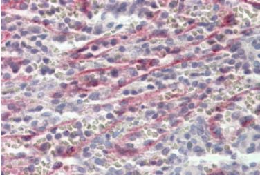 Staining of paraffin embedded Human Spleen using Stabilin 1 Antibody at 3.8 ug/ml. Steamed antigen retrieval with citrate buffer pH 6, AP-staining.