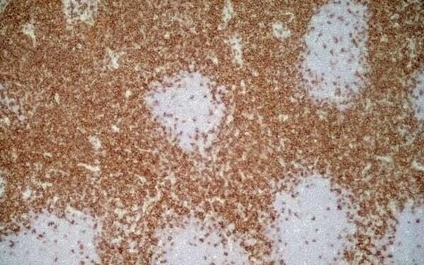 Immunoperoxidase staining of rat lymph node cryosetion using Mouse anti Rat CD4 antibody, clone W5/25 (<strong><a href="https://www.bio-rad-antibodies.com/rat-cd4-antibody-w3-25-mca55g.html"target="_blank">MCA55R</a></strong>) followed by horseradish peroxidase conjugated Goat anti Mouse IgG1 antibody (<strong>STAR132P</strong>) for detection. Low power.