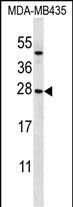 KLRC1 Antibody (N-term) (Cat. #AP52396PU-N) western blot analysis in MDA-MB435 cell line lysates (35ug/lane).This demonstrates the KLRC1 antibody detected the KLRC1 protein (arrow).