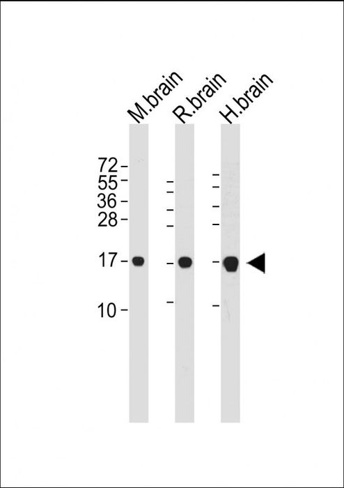 All lanes : Anti-MAP1LC3A Antibody at  dilution Lane 1: Mouse brain whole cell lysate Lane 2: Rat brain whole cell lysate Lane 3: Human brain whole cell lysate  Lysates/proteins at 20 µg per lane.   Secondary Goat Anti-mouse IgG,  (H+L), Peroxidase conjugated at 1/10000 dilution.   Predicted band size : 14 kDa  Blocking/Dilution buffer: 5% NFDM/TBST.
