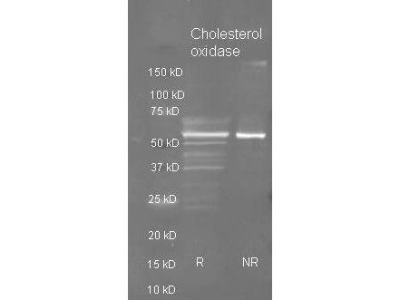 Rockland Goat anti Cholesterol oxidase antibody (200-101-213 lot 6534) was used to detect purified cholesterol oxidase under reducing (R) and non-reducing (NR) conditions. Reduced samples of purified cholesterol oxidase contained 4% BME and were boiled for 5 minutes.  Samples of ~1ug of protein per lane were run by SDS-PAGE.  Protein was transferred to nitrocellulose and probed with a 1:3000 dilution of primary antibody (ON 4 C in MB-070).  Detection shown was using Dylight 488 conjugated Donkey anti goat (605-741-125 lot 21094 1:10K in TBS/MB-070 1 hr RT).   Images were collected using the BioRad VersaDoc System.