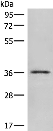 Gel: 8%SDS-PAGE<br>Lysate: 40 μg<br>Lane: Human skin tissue lysate<br>Primary antibody: TA322508 (CLEC10A Antibody) at dilution 1/300<br>Secondary antibody: Goat anti rabbit IgG at 1/8000 dilution<br>Exposure time: 1 minute
