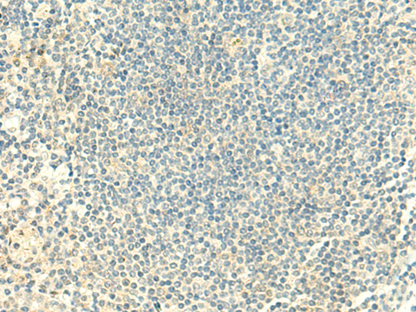 Immunohistochemistry of paraffin-embedded Human tonsil tissue using TA322508 (CLEC10A Antibody) at dilution 1/50 (Original magnification: ×200)