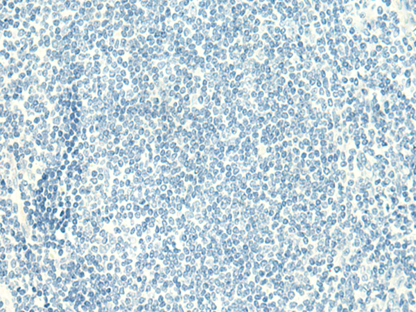 Immunohistochemistry of paraffin-embedded Human tonsil tissue using TA322508 (CLEC10A Antibody) at dilution 1/50, treated with fusion protein. (Original magnification: ×200)