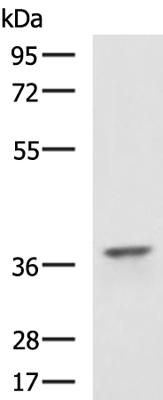 Gel: 8%SDS-PAGE<br>Lysate: 40 μg<br>Lane: Jurkat cell lysate<br>Primary antibody: TA323939 (CDK6 Antibody) at dilution 1/800<br>Secondary antibody: Goat anti rabbit IgG at 1/5000 dilution<br>Exposure time: 1 minute