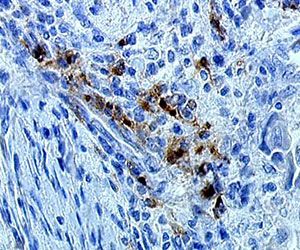 IHC staining of human lymph node paraffin section with clone 1010E1 (DX0191)