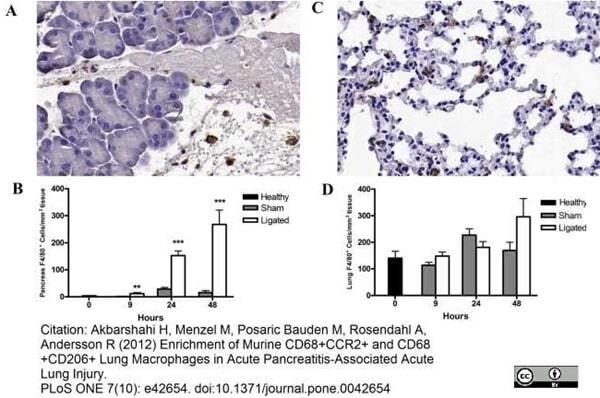 <strong>Published customer image:</strong> <br>Rat anti Mouse F4/80 antibody, clone A3-1 (<strong>MCA497G</strong>) used for the detection of macrophages in mouse lung and pancreas by immunohistochemistery on formalin fixed, paraffin tissue sections.<br><strong>Image caption:</strong><br>Changes in pancreatic and lung F4/80+ macrophage number during acute pancreatitis. Representative photomicrographs of pancreas (A) and lung (C) sections stained for F4/80 as indicator of macrophage infiltration (brown) 24 h after pancreatitis induction (original magnification, ×20). Quantification of F4/80+ cells showed a significantly increased enrichment in the pancreas from 9 h following pancreatitis compared to sham controls (B). No significant difference was observed in the number of lung F4/80+ cells between pancreatitis and sham control groups (D). Bars show mean &plusmn; SEM, n = 10 per group. **P<0.01, ***P<0.001, by two-tailed Student t-test.<br><br>From: Akbarshahi H, Menzel M, Posaric Bauden M, Rosendahl A, Andersson R (2012)<br>Enrichment of Murine CD68+CCR2+ and CD68+CD206+ Lung Macrophages in Acute Pancreatitis-Associated Acute Lung Injury.<br><strong><a href="https://www.ncbi.nlm.nih.gov/pubmed/23110041"target="_blank" rel="noopener">PLoS ONE 7(10): e42654</a></strong>.<br>This image is from an open access article distributed under the terms of the <a href="https://creativecommons.org/licenses/by/4.0/"target="_blank" rel="noopener">Creative Commons Attribution License</a>.