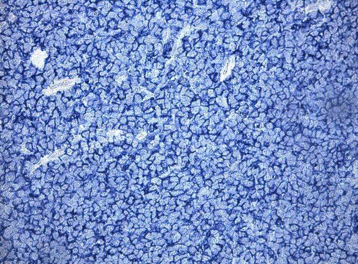 Human tonsil stained with with OriGene Mouse anti MS4A1 (<a href = "https://www.origene.com/catalog/antibodies/primary-antibodies/um800009-cd20-ms4a1-mouse-monoclonal-antibody-clone-id-umab58" title="UM800009" class="">UM800009</a> diluted 1:600) seen as the blue membrane stain  HIER buffer TEE (B21C-100) was used 10 minutes pressure cooker. Secondary Polink1 anti-Ms D18-100, and AP Blue chromogens was mix prior to placing on tissue for 10 minutes.