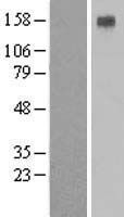 Western blot validation of overexpression lysate (Cat# <a href = "https://www.origene.com/catalog/proteins/over-expression-lysates/ly424563-atp4a-nm-000704-human-over-expression-lysate" title="LY424563" class="">LY424563</a>) using anti-DDK antibody (Cat# <a href = "https://www.origene.com/catalog/antibodies/tag-antibodies/ta50011-100-clone-oti4c5-anti-ddk-flag-monoclonal-antibody" title="TA50011-100" class="">TA50011-100</a>). Left: Cell lysates from un-transfected HEK293T cells; Right: Cell lysates from HEK293T cells transfected with RC211772 using transfection reagent MegaTran 2.0 (Cat# <a href = "https://www.origene.com/catalog/others/transfection-reagents/tt210002-megatran-20-plasmid-dna-transfection-reagent-05-ml" title="TT210002" class="">TT210002</a>).