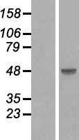 Western blot validation of overexpression lysate (Cat# <a href = "https://www.origene.com/catalog/proteins/over-expression-lysates/ly401784-smad3-nm-005902-human-over-expression-lysate" title="LY401784" class="">LY401784</a>) using anti-DDK antibody (Cat# <a href = "https://www.origene.com/catalog/antibodies/tag-antibodies/ta50011-100-clone-oti4c5-anti-ddk-flag-monoclonal-antibody" title="TA50011-100" class="">TA50011-100</a>). Left: Cell lysates from un-transfected HEK293T cells; Right: Cell lysates from HEK293T cells transfected with <a href = "https://www.origene.com/catalog/cdna-clones/expression-plasmids/rc208749-smad3-nm-005902-human-tagged-orf-clone" title="RC208749" class="">RC208749</a> using transfection reagent MegaTran 2.0 (Cat# <a href = "https://www.origene.com/catalog/others/transfection-reagents/tt210002-megatran-20-plasmid-dna-transfection-reagent-05-ml" title="TT210002" class="">TT210002</a>).