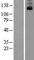 Western blot validation of overexpression lysate (Cat# LY412293) using anti-DDK antibody (Cat# <a href = "https://www.origene.com/catalog/antibodies/tag-antibodies/ta50011-100-clone-oti4c5-anti-ddk-flag-monoclonal-antibody" title="TA50011-100" class="">TA50011-100</a>). Left: Cell lysates from un-transfected HEK293T cells; Right: Cell lysates from HEK293T cells transfected with <a href = "https://www.origene.com/catalog/cdna-clones/expression-plasmids/rc214820-kcnt1-nm-020822-human-tagged-orf-clone" title="RC214820" class="">RC214820</a> using transfection reagent MegaTran 2.0 (Cat# <a href = "https://www.origene.com/catalog/others/transfection-reagents/tt210002-megatran-20-plasmid-dna-transfection-reagent-05-ml" title="TT210002" class="">TT210002</a>).