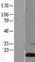 Western blot validation of overexpression lysate (Cat# LY400845) using anti-DDK antibody (Cat# <a href = "https://www.origene.com/catalog/antibodies/tag-antibodies/ta50011-100-clone-oti4c5-anti-ddk-flag-monoclonal-antibody" title="TA50011-100" class="">TA50011-100</a>). Left: Cell lysates from un-transfected HEK293T cells; Right: Cell lysates from HEK293T cells transfected with <a href = "https://www.origene.com/catalog/cdna-clones/expression-plasmids/rc204723-sh2d1a-nm-002351-human-tagged-orf-clone" title="RC204723" class="">RC204723</a> using transfection reagent MegaTran 2.0 (Cat# <a href = "https://www.origene.com/catalog/others/transfection-reagents/tt210002-megatran-20-plasmid-dna-transfection-reagent-05-ml" title="TT210002" class="">TT210002</a>).