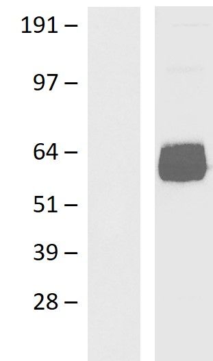 Western blot validation of overexpression lysate (Cat# <a href = "https://www.origene.com/catalog/proteins/over-expression-lysates/ly401951-poliovirus-receptor-pvr-nm-006505-human-over-expression-lysate" title="LY401951" class="">LY401951</a>) using anti-DDK antibody (Cat# <a href = "https://www.origene.com/catalog/antibodies/tag-antibodies/ta592569-ddk-rabbit-monoclonal-antibody-recognizing-both-n-and-c-terminal-tags" title="TA592569" class="">TA592569</a>). Left: Cell lysates from un-transfected HEK293T cells; Right: Cell lysates from HEK293T cells transfected with RC202254 using transfection reagent PEI.
