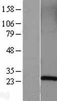 Western blot validation of overexpression lysate (Cat# <a href = "https://www.origene.com/catalog/proteins/over-expression-lysates/ly401339-rab5-rab5a-nm-004162-human-over-expression-lysate" title="LY401339" class="">LY401339</a>) using anti-DDK antibody (Cat# <a href = "https://www.origene.com/catalog/antibodies/tag-antibodies/ta50011-100-clone-oti4c5-anti-ddk-flag-monoclonal-antibody" title="TA50011-100" class="">TA50011-100</a>). Left: Cell lysates from un-transfected HEK293T cells; Right: Cell lysates from HEK293T cells transfected with <a href = "https://www.origene.com/catalog/cdna-clones/expression-plasmids/rc203873-rab5-rab5a-nm-004162-human-tagged-orf-clone" title="RC203873" class="">RC203873</a> using transfection reagent MegaTran 2.0 (Cat# <a href = "https://www.origene.com/catalog/others/transfection-reagents/tt210002-megatran-20-plasmid-dna-transfection-reagent-05-ml" title="TT210002" class="">TT210002</a>).