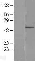 Western blot validation of overexpression lysate (Cat# LY402777) using anti-DDK antibody (Cat# <a href = "https://www.origene.com/catalog/antibodies/tag-antibodies/ta50011-100-clone-oti4c5-anti-ddk-flag-monoclonal-antibody" title="TA50011-100" class="">TA50011-100</a>). Left: Cell lysates from un-transfected HEK293T cells; Right: Cell lysates from HEK293T cells transfected with <a href = "https://www.origene.com/catalog/cdna-clones/expression-plasmids/rc205708-adipose-triglyceride-lipase-pnpla2-nm-020376-human-tagged-orf-clone" title="RC205708" class="">RC205708</a> using transfection reagent MegaTran 2.0 (Cat# <a href = "https://www.origene.com/catalog/others/transfection-reagents/tt210002-megatran-20-plasmid-dna-transfection-reagent-05-ml" title="TT210002" class="">TT210002</a>).