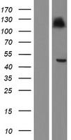 Western blot validation of overexpression lysate (Cat# LY420587) using anti-DDK antibody (Cat# <a href = "https://www.origene.com/catalog/antibodies/tag-antibodies/ta50011-100-clone-oti4c5-anti-ddk-flag-monoclonal-antibody" title="TA50011-100" class="">TA50011-100</a>). Left: Cell lysates from un-transfected HEK293T cells; Right: Cell lysates from HEK293T cells transfected with <a href = "https://www.origene.com/catalog/cdna-clones/expression-plasmids/rc212120-hlaf-hla-f-nm-001098479-human-tagged-orf-clone" title="RC212120" class="">RC212120</a> using transfection reagent MegaTran 2.0 (Cat# <a href = "https://www.origene.com/catalog/others/transfection-reagents/tt210002-megatran-20-plasmid-dna-transfection-reagent-05-ml" title="TT210002" class="">TT210002</a>).