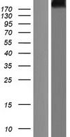 Western blot validation of overexpression lysate (Cat# <a href = "https://www.origene.com/catalog/proteins/over-expression-lysates/ly421147-cubilin-cubn-nm-001081-human-over-expression-lysate" title="LY421147" class="">LY421147</a>) using anti-DDK antibody (Cat# <a href = "https://www.origene.com/catalog/antibodies/tag-antibodies/ta50011-100-clone-oti4c5-anti-ddk-flag-monoclonal-antibody" title="TA50011-100" class="">TA50011-100</a>). Left: Cell lysates from un-transfected HEK293T cells; Right: Cell lysates from HEK293T cells transfected with <a href = "https://www.origene.com/catalog/cdna-clones/expression-plasmids/rc217507-cubilin-cubn-nm-001081-human-tagged-orf-clone" title="RC217507" class="">RC217507</a> using transfection reagent MegaTran 2.0 (Cat# <a href = "https://www.origene.com/catalog/others/transfection-reagents/tt210002-megatran-20-plasmid-dna-transfection-reagent-05-ml" title="TT210002" class="">TT210002</a>).