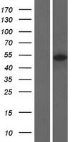 Western blot validation of overexpression lysate (Cat# LY433068) using anti-DDK antibody (Cat# <a href = "https://www.origene.com/catalog/antibodies/tag-antibodies/ta50011-100-clone-oti4c5-anti-ddk-flag-monoclonal-antibody" title="TA50011-100" class="">TA50011-100</a>). Left: Cell lysates from un-transfected HEK293T cells; Right: Cell lysates from HEK293T cells transfected with <a href = "https://www.origene.com/catalog/cdna-clones/expression-plasmids/rc230068-glycogenin-2-gyg2-nm-001184703-human-tagged-orf-clone" title="RC230068" class="">RC230068</a> using transfection reagent MegaTran 2.0 (Cat# <a href = "https://www.origene.com/catalog/others/transfection-reagents/tt210002-megatran-20-plasmid-dna-transfection-reagent-05-ml" title="TT210002" class="">TT210002</a>).