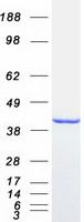 Coomassie blue staining of purified ABHD5 protein (Cat# TP301869). The protein was produced from HEK293T cells transfected with ABHD5 cDNA clone (Cat# <a href = "https://www.origene.com/catalog/cdna-clones/expression-plasmids/rc201869-abhd5-nm-016006-human-tagged-orf-clone" title="RC201869" class="">RC201869</a>) using MegaTran 2.0 (Cat# <a href = "https://www.origene.com/catalog/others/transfection-reagents/tt210002-megatran-20-plasmid-dna-transfection-reagent-05-ml" title="TT210002" class="">TT210002</a>).