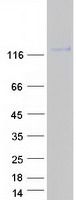 Coomassie blue staining of purified CD44 protein (Cat# TP302455). The protein was produced from HEK293T cells transfected with CD44 cDNA clone (Cat# <a href = "https://www.origene.com/catalog/cdna-clones/expression-plasmids/rc202455-cd44-nm-001001389-human-tagged-orf-clone" title="RC202455" class="">RC202455</a>) using MegaTran 2.0 (Cat# <a href = "https://www.origene.com/catalog/others/transfection-reagents/tt210002-megatran-20-plasmid-dna-transfection-reagent-05-ml" title="TT210002" class="">TT210002</a>).