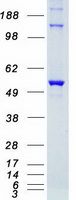 Coomassie blue staining of purified STK38 protein (Cat# TP304133). The protein was produced from HEK293T cells transfected with STK38 cDNA clone (Cat# <a href = "https://www.origene.com/catalog/cdna-clones/expression-plasmids/rc204133-stk38-nm-007271-human-tagged-orf-clone" title="RC204133" class="">RC204133</a>) using MegaTran 2.0 (Cat# <a href = "https://www.origene.com/catalog/others/transfection-reagents/tt210002-megatran-20-plasmid-dna-transfection-reagent-05-ml" title="TT210002" class="">TT210002</a>).
