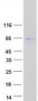 Coomassie blue staining of purified PNPLA2 protein (Cat# TP305708). The protein was produced from HEK293T cells transfected with PNPLA2 cDNA clone (Cat# <a href = "https://www.origene.com/catalog/cdna-clones/expression-plasmids/rc205708-adipose-triglyceride-lipase-pnpla2-nm-020376-human-tagged-orf-clone" title="RC205708" class="">RC205708</a>) using MegaTran 2.0 (Cat# <a href = "https://www.origene.com/catalog/others/transfection-reagents/tt210002-megatran-20-plasmid-dna-transfection-reagent-05-ml" title="TT210002" class="">TT210002</a>).