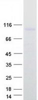 Coomassie blue staining of purified TLR2 protein (Cat# TP307597). The protein was produced from HEK293T cells transfected with TLR2 cDNA clone (Cat# <a href = "https://www.origene.com/catalog/cdna-clones/expression-plasmids/rc207597-tlr2-nm-003264-human-tagged-orf-clone" title="RC207597" class="">RC207597</a>) using MegaTran 2.0 (Cat# <a href = "https://www.origene.com/catalog/others/transfection-reagents/tt210002-megatran-20-plasmid-dna-transfection-reagent-05-ml" title="TT210002" class="">TT210002</a>).