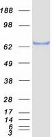 Coomassie blue staining of purified SOX9 protein (Cat# <a href = "https://www.origene.com/catalog/proteins/recombinant-proteins/tp308944-sox9-nm-000346-human-recombinant-protein" title="TP308944" class="">TP308944</a>). The protein was produced from HEK293T cells transfected with SOX9 cDNA clone (Cat# <a href = "https://www.origene.com/catalog/cdna-clones/expression-plasmids/rc208944-sox9-nm-000346-human-tagged-orf-clone" title="RC208944" class="">RC208944</a>) using MegaTran 2.0 (Cat# <a href = "https://www.origene.com/catalog/others/transfection-reagents/tt210002-megatran-20-plasmid-dna-transfection-reagent-05-ml" title="TT210002" class="">TT210002</a>).