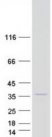 Coomassie blue staining of purified COQ3 protein (Cat# TP309576). The protein was produced from HEK293T cells transfected with COQ3 cDNA clone (Cat# <a href = "https://www.origene.com/catalog/cdna-clones/expression-plasmids/rc209576-coq3-nm-017421-human-tagged-orf-clone" title="RC209576" class="">RC209576</a>) using MegaTran 2.0 (Cat# <a href = "https://www.origene.com/catalog/others/transfection-reagents/tt210002-megatran-20-plasmid-dna-transfection-reagent-05-ml" title="TT210002" class="">TT210002</a>).