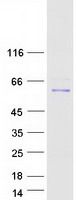 Coomassie blue staining of purified RBPJ protein (Cat# <a href = "https://www.origene.com/catalog/proteins/recombinant-proteins/tp309094-rbpjk-rbpj-nm-203284-human-recombinant-protein" title="TP309094" class="">TP309094</a>). The protein was produced from HEK293T cells transfected with RBPJ cDNA clone (Cat# <a href = "https://www.origene.com/catalog/cdna-clones/expression-plasmids/rc209094-rbpjk-rbpj-nm-203284-human-tagged-orf-clone" title="RC209094" class="">RC209094</a>) using MegaTran 2.0 (Cat# <a href = "https://www.origene.com/catalog/others/transfection-reagents/tt210002-megatran-20-plasmid-dna-transfection-reagent-05-ml" title="TT210002" class="">TT210002</a>).