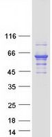 Coomassie blue staining of purified TH protein (Cat# <a href = "https://www.origene.com/catalog/proteins/recombinant-proteins/tp311218-tyrosine-hydroxylase-th-nm-000360-human-recombinant-protein" title="TP311218" class="">TP311218</a>). The protein was produced from HEK293T cells transfected with TH cDNA clone (Cat# <a href = "https://www.origene.com/catalog/cdna-clones/expression-plasmids/rc211218-tyrosine-hydroxylase-th-nm-000360-human-tagged-orf-clone" title="RC211218" class="">RC211218</a>) using MegaTran 2.0 (Cat# <a href = "https://www.origene.com/catalog/others/transfection-reagents/tt210002-megatran-20-plasmid-dna-transfection-reagent-05-ml" title="TT210002" class="">TT210002</a>).