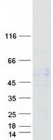 Coomassie blue staining of purified GABRA5 protein (Cat# <a href = "https://www.origene.com/catalog/proteins/recombinant-proteins/tp316541-gaba-a-receptor-alpha-5-gabra5-nm-000810-human-recombinant-protein" title="TP316541" class="">TP316541</a>). The protein was produced from HEK293T cells transfected with GABRA5 cDNA clone (Cat# <a href = "https://www.origene.com/catalog/cdna-clones/expression-plasmids/rc216541-gaba-a-receptor-alpha-5-gabra5-nm-000810-human-tagged-orf-clone" title="RC216541" class="">RC216541</a>) using MegaTran 2.0 (Cat# <a href = "https://www.origene.com/catalog/others/transfection-reagents/tt210002-megatran-20-plasmid-dna-transfection-reagent-05-ml" title="TT210002" class="">TT210002</a>).