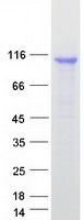 Coomassie blue staining of purified DDX58 protein (Cat# TP317615). The protein was produced from HEK293T cells transfected with DDX58 cDNA clone (Cat# <a href = "https://www.origene.com/catalog/cdna-clones/expression-plasmids/rc217615-ddx58-nm-014314-human-tagged-orf-clone" title="RC217615" class="">RC217615</a>) using MegaTran 2.0 (Cat# <a href = "https://www.origene.com/catalog/others/transfection-reagents/tt210002-megatran-20-plasmid-dna-transfection-reagent-05-ml" title="TT210002" class="">TT210002</a>).
