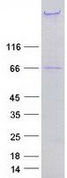 Coomassie blue staining of purified NES protein (Cat# <a href = "https://www.origene.com/catalog/proteins/recombinant-proteins/tp318197-nestin-nes-nm-006617-human-recombinant-protein" title="TP318197" class="">TP318197</a>). The protein was produced from HEK293T cells transfected with NES cDNA clone (Cat# <a href = "https://www.origene.com/catalog/cdna-clones/expression-plasmids/rc218197-nestin-nes-nm-006617-human-tagged-orf-clone" title="RC218197" class="">RC218197</a>) using MegaTran 2.0 (Cat# <a href = "https://www.origene.com/catalog/others/transfection-reagents/tt210002-megatran-20-plasmid-dna-transfection-reagent-05-ml" title="TT210002" class="">TT210002</a>).