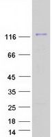 Coomassie blue staining of purified USP16 protein (Cat# TP322609). The protein was produced from HEK293T cells transfected with USP16 cDNA clone (Cat# <a href = "https://www.origene.com/catalog/cdna-clones/expression-plasmids/rc222609-usp16-nm-006447-human-tagged-orf-clone" title="RC222609" class="">RC222609</a>) using MegaTran 2.0 (Cat# <a href = "https://www.origene.com/catalog/others/transfection-reagents/tt210002-megatran-20-plasmid-dna-transfection-reagent-05-ml" title="TT210002" class="">TT210002</a>).