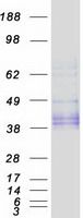 Coomassie blue staining of purified OGN protein (Cat# TP323948). The protein was produced from HEK293T cells transfected with OGN cDNA clone (Cat# <a href = "https://www.origene.com/catalog/cdna-clones/expression-plasmids/rc223948-oif-ogn-nm-033014-human-tagged-orf-clone" title="RC223948" class="">RC223948</a>) using MegaTran 2.0 (Cat# <a href = "https://www.origene.com/catalog/others/transfection-reagents/tt210002-megatran-20-plasmid-dna-transfection-reagent-05-ml" title="TT210002" class="">TT210002</a>).
