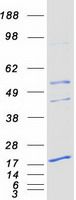 Coomassie blue staining of purified PEMT protein (Cat# TP323190). The protein was produced from HEK293T cells transfected with PEMT cDNA clone (Cat# <a href = "https://www.origene.com/catalog/cdna-clones/expression-plasmids/rc223190-peamt-pemt-nm-007169-human-tagged-orf-clone" title="RC223190" class="">RC223190</a>) using MegaTran 2.0 (Cat# <a href = "https://www.origene.com/catalog/others/transfection-reagents/tt210002-megatran-20-plasmid-dna-transfection-reagent-05-ml" title="TT210002" class="">TT210002</a>).