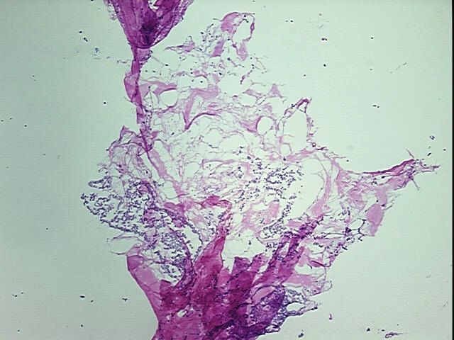 4x Image