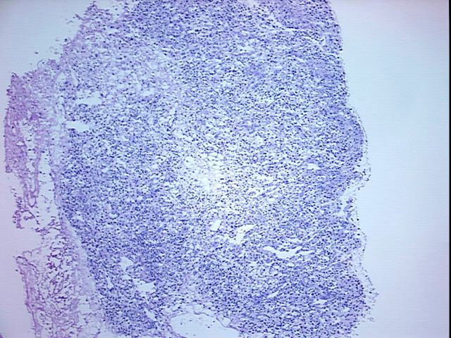 DNA - 4x.