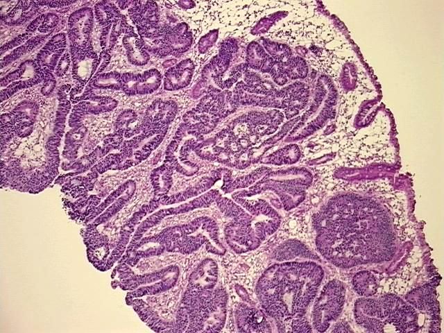 4x Image