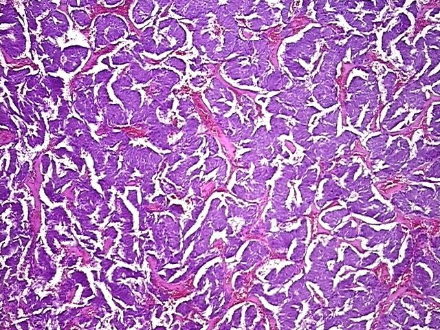4x Image