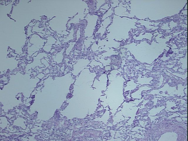 4x Image