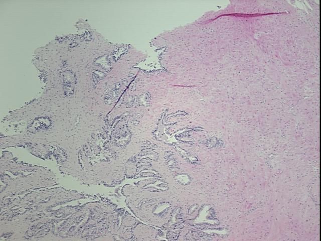 4x Image