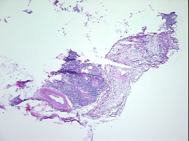 4x Image