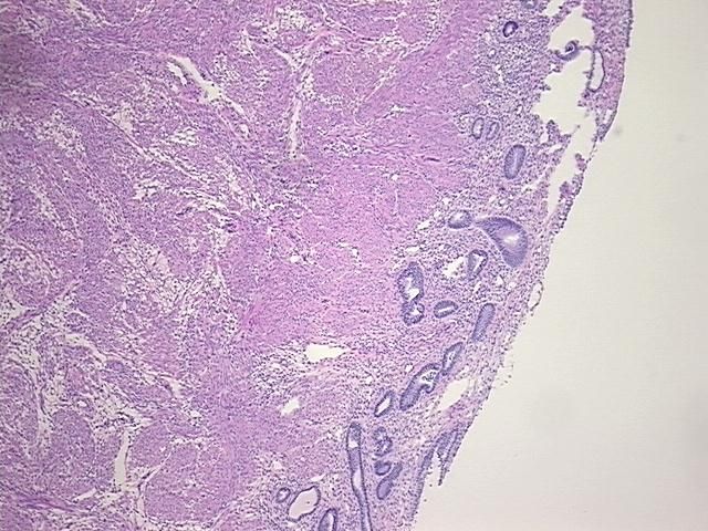 4x Image