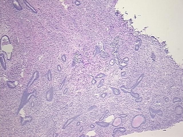 4x Image