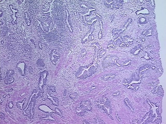 4x Image