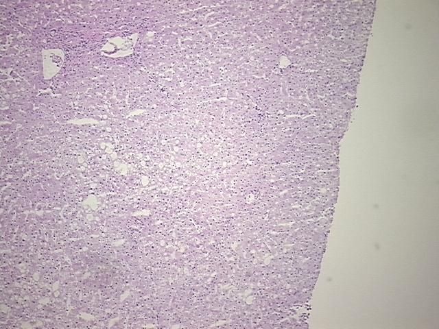 4x Image